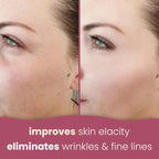 Turmeric Kojic Acid Pads(PACK OF 20 PADS😍)