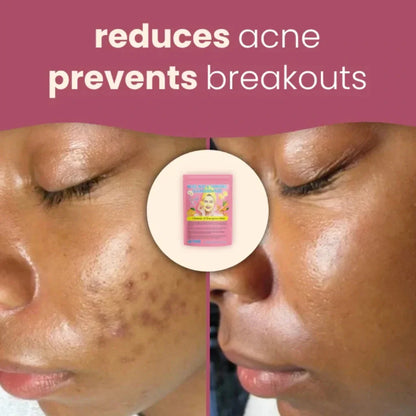Turmeric Kojic Acid Pads(PACK OF 20 PADS😍)