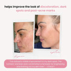 Turmeric Kojic Acid Pads(PACK OF 20 PADS😍)