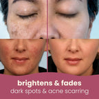 Turmeric Kojic Acid Pads(PACK OF 20 PADS😍)