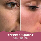 Turmeric Kojic Acid Pads(PACK OF 20 PADS😍)